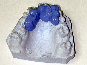 Silicona fluida 2