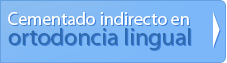 Tecnica Lingual