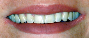 Sonrisa